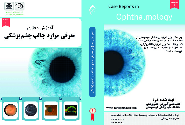 آموزش مجازی معرفی موارد جالب چشم پزشکی