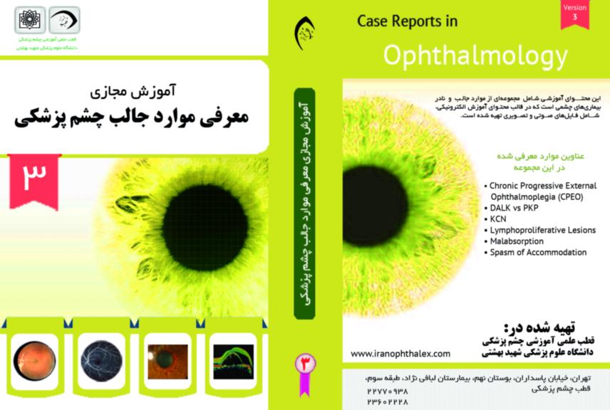 آموزش مجازی معرفی موارد جالب چشم پزشکی